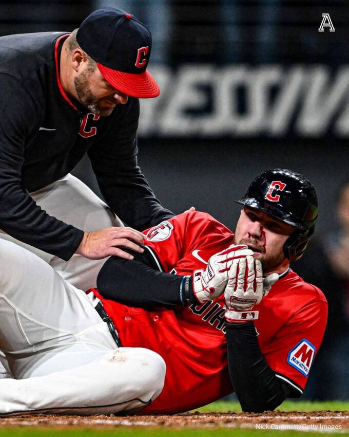 Во время матча MLB спортсмен был госпитализирован после удара бейсбольным мячом
